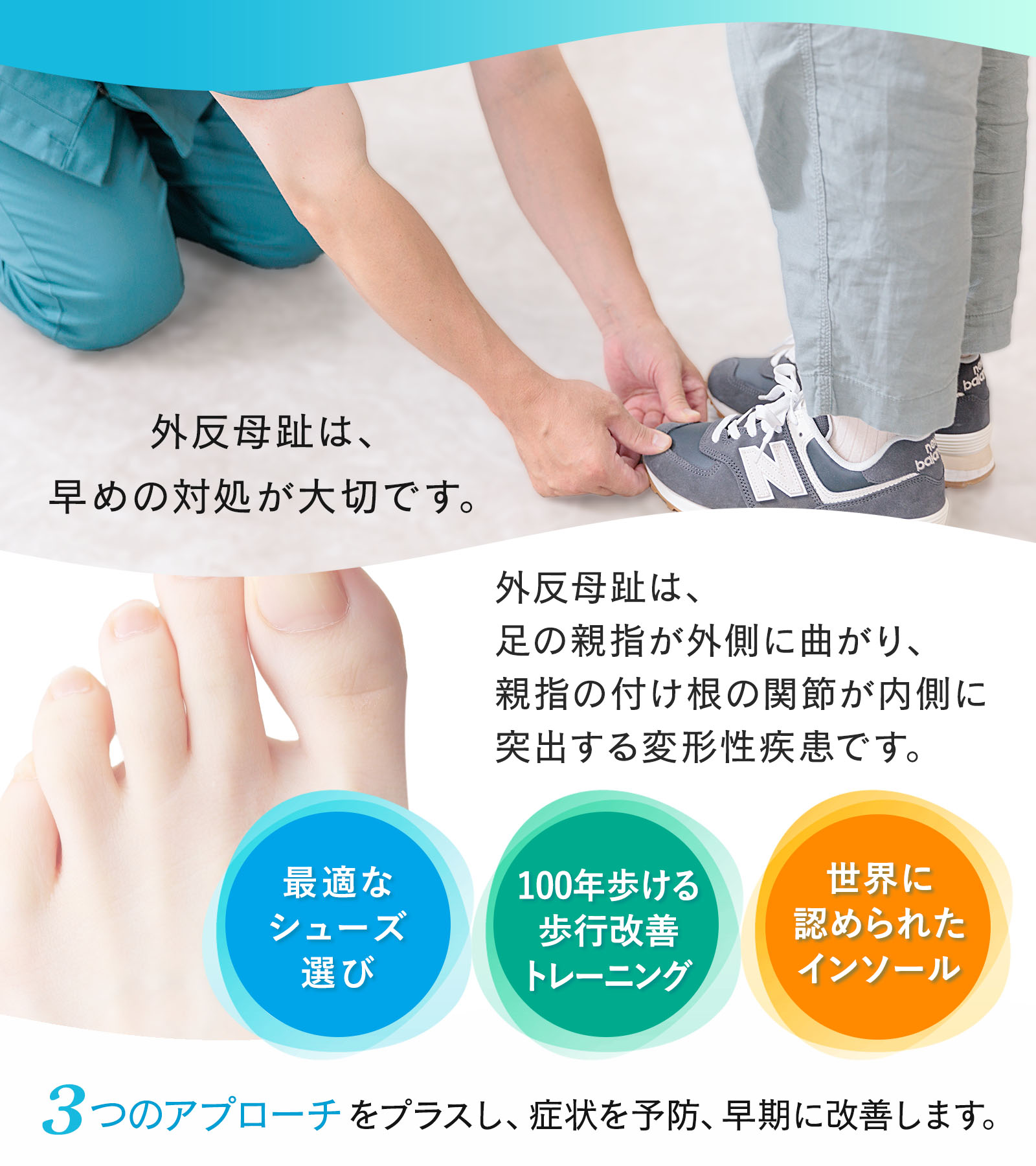 外反母趾は、早めの対処が大切です。外反母趾は、 足の親指が外側に曲がり、 親指の付け根の関節が内側に 突出する変形性疾患です。